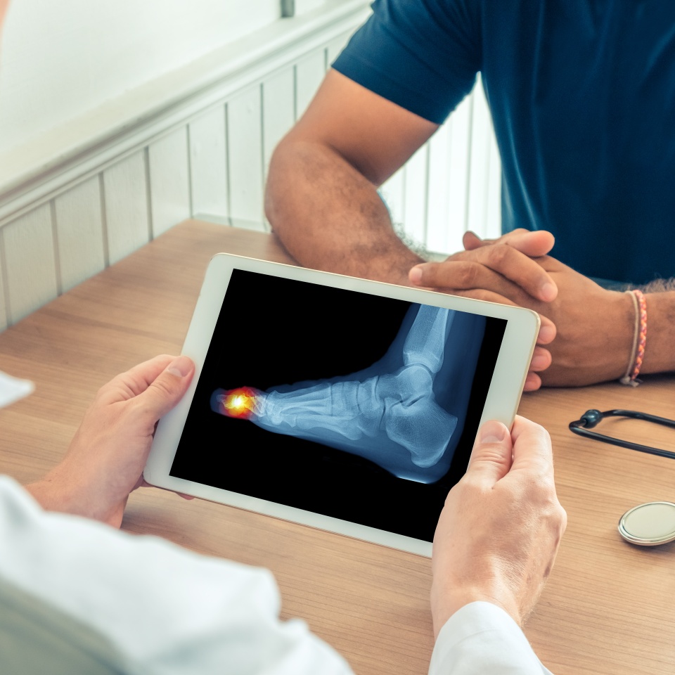 Doctor holding a digital tablet with x-ray of foot of the patient. Pain in the toe