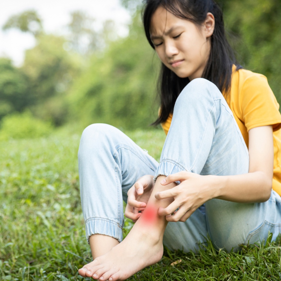 Asian child girl scratching itch on her leg with hand,female teenage with red rash,mosquito bite,fungal infection,insect bites,legs itching allergy,rash while sitting on the grass at park,Anaphylaxis