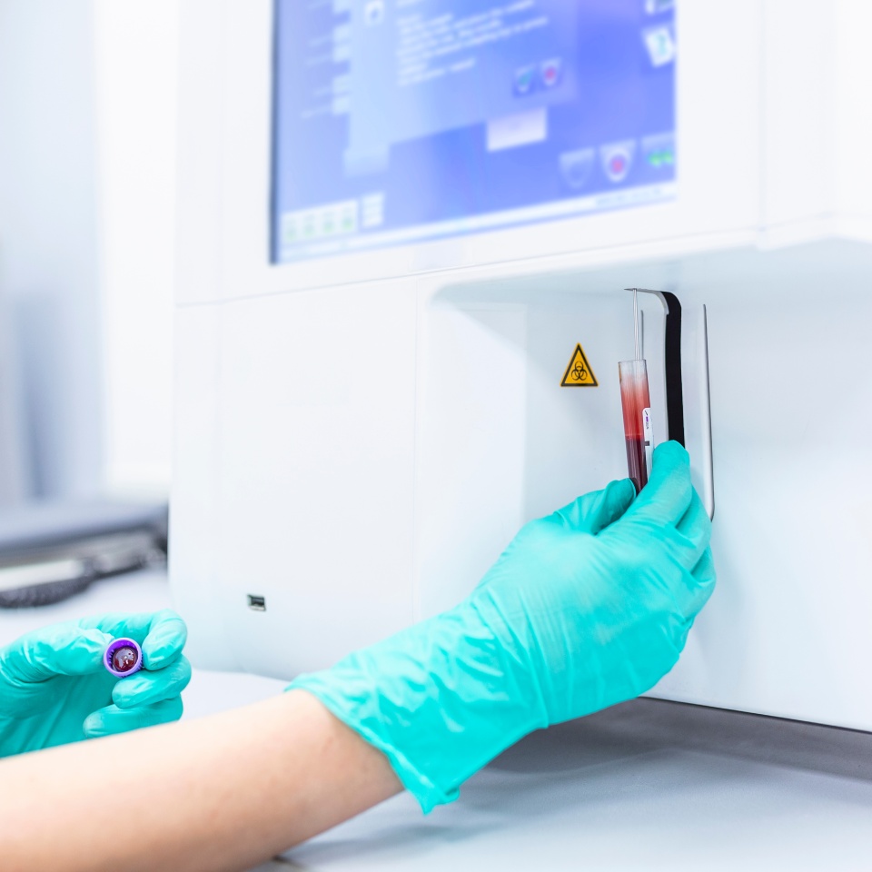 Lab technician holding blood in EDTA tube for test complete Blood Count (cbc) testing hematology laboratory. Scientific medical test with automated hematology analysis.