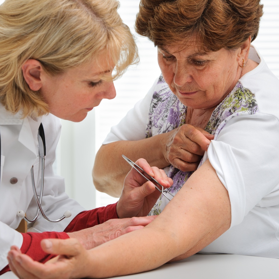 Doctor removing a tick with tweezers from skin of patient