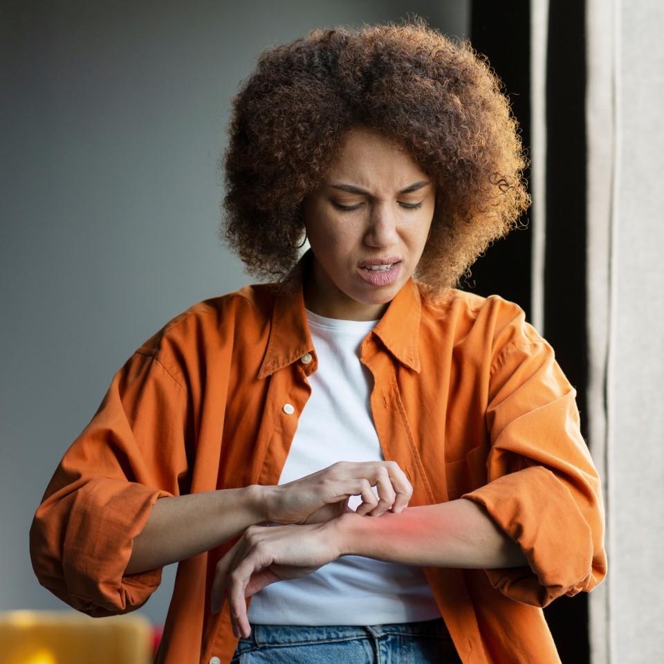 Anxious young African American woman self harming while scratching her hand, feeling annoying itching. Skin allergic reaction. Allergology. Dermatology. Skin problems. Health and medicine concept