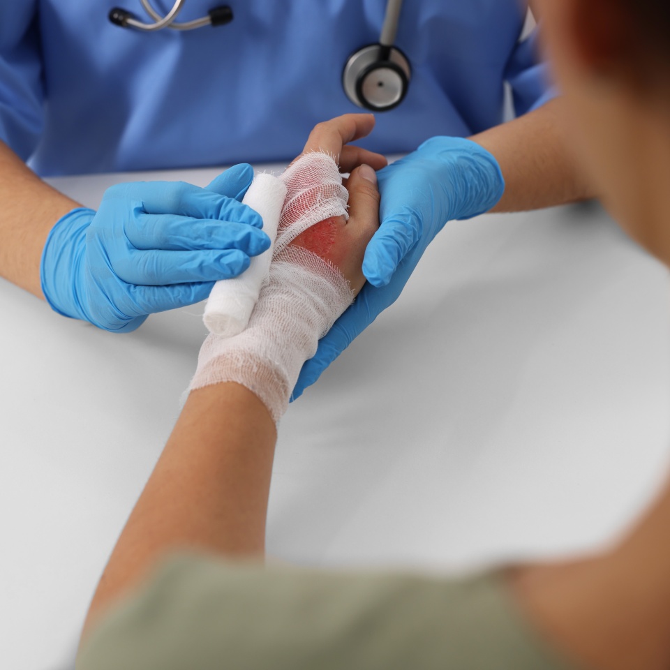 Doctor bandaging patient's burned hand at table, closeup
