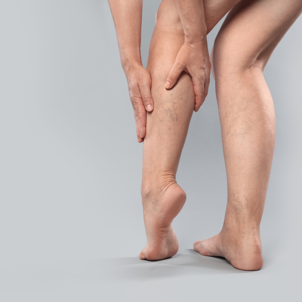 Woman suffering from varicose veins on grey background, closeup. Space for text