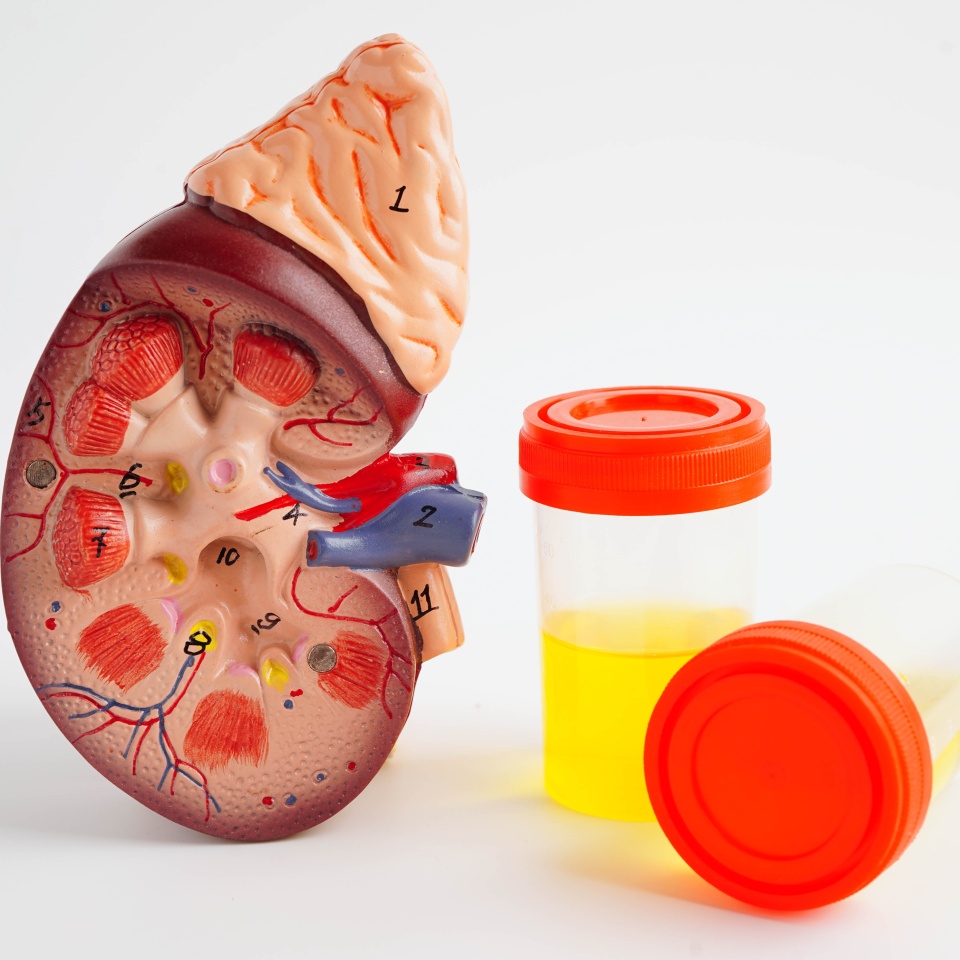 Urinalysis, Kidney and urine cup for check health examination in laboratory.